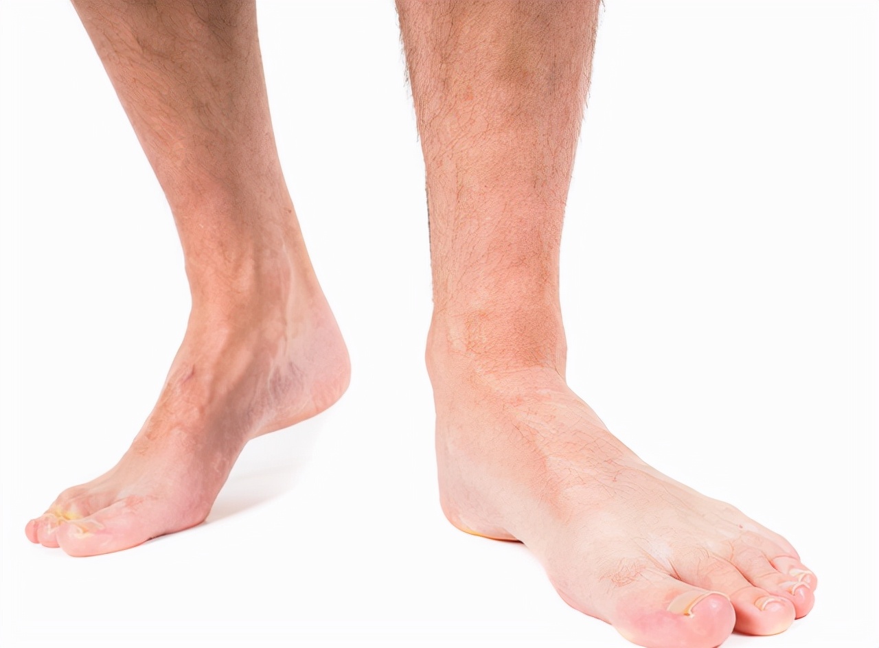 男性腿毛旺盛的坏处,男性腿毛稀疏是因为什么