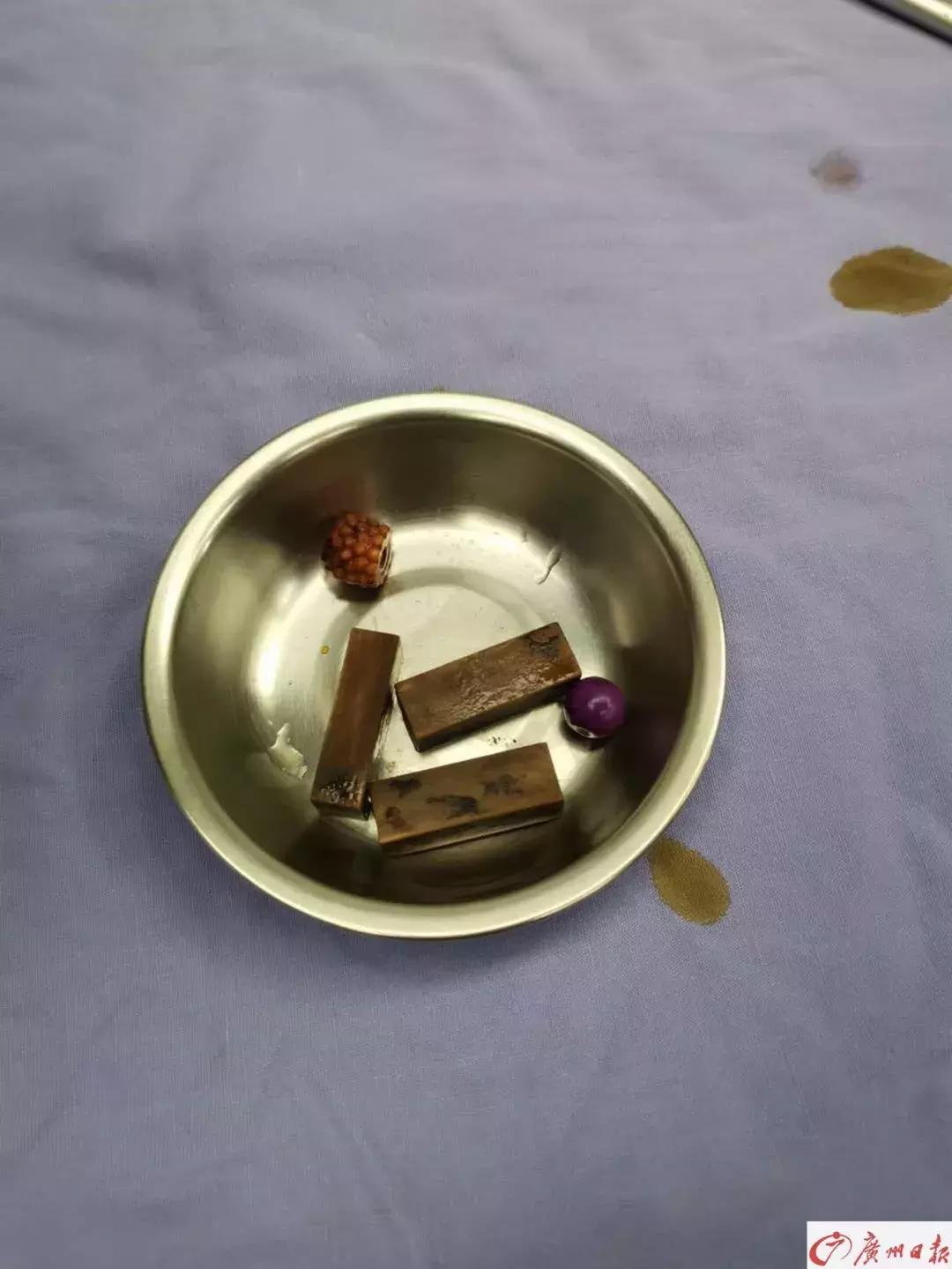 妈妈发现女儿身上有怪味,8岁女童身上总有恶臭