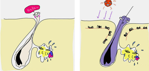 关于各种痘痘的在线咨询,治疗痘痘的分享