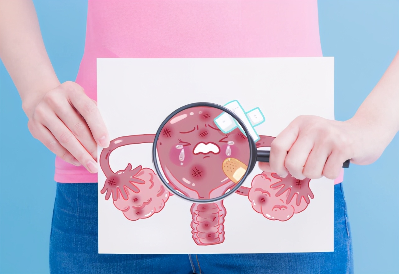 女性排便有粘液,排便有问题小心妇科疾病