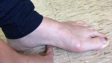 足部ct可以看出是不是扁平足吗,孩子脚部知识