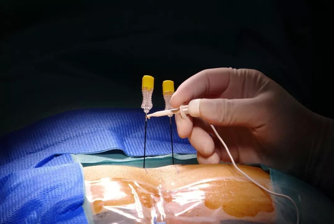 下肢截瘫康复成功案例,全国治疗截瘫最新突破