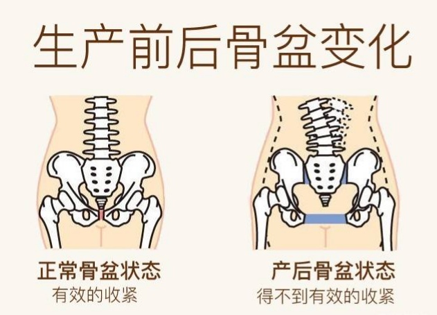 顺产后的影响,顺产9斤巨大儿对产妇的影响