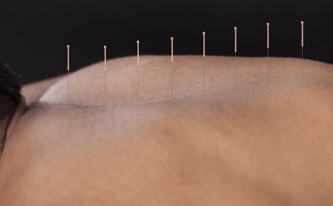 针灸对于腰椎疾病有什么作用,针灸治疗的五种常见病