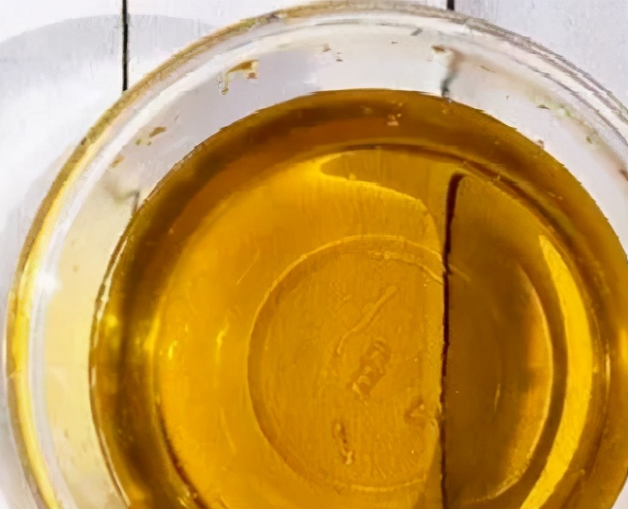 男性脱发怎么办最有效的方法,油脂性脱发治疗最有效的方法