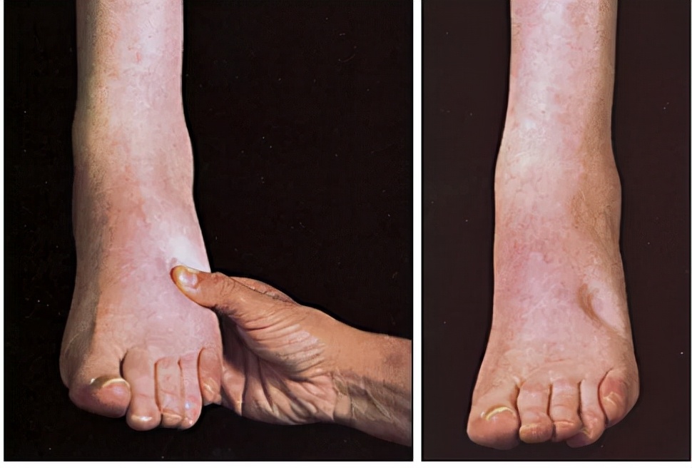 为什么肾不好会胖,为什么肾不好的人尿多