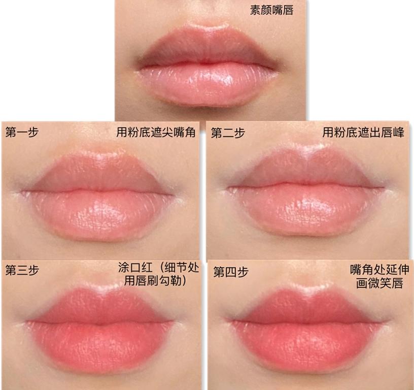 骨相凹陷怎么办,骨相扁平怎么改善