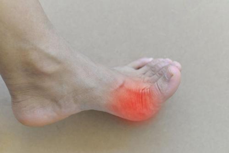 痛风慢性期怎么治愈,痛风慢性期可用哪种药物维持治疗