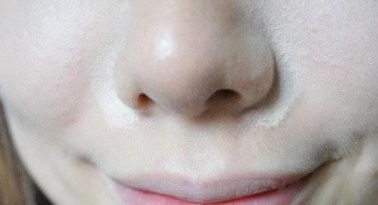 皮肤不吸收水是什么原因,皮肤搓泥不吸收护肤品怎么办