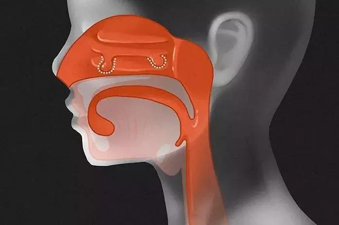 咽喉肿痛输液用什么药,咽喉肿痛打针还是吃药