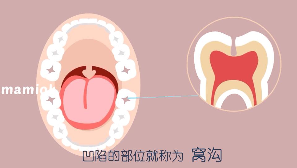 每个饱受“蛀牙”折磨的妈妈都走上了这条路……