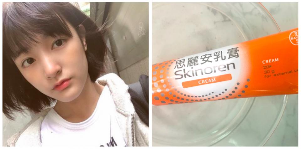 明星推荐的草本祛痘膏,女明星用的药膏