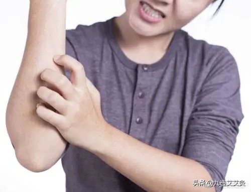 面部艾灸后皮肤痒和起疙瘩,艾灸治疗皮肤肿痒