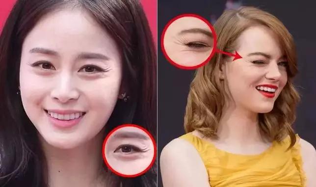 去眼纹去黑眼圈用什么方法,去眼袋黑公认最好用的土方法