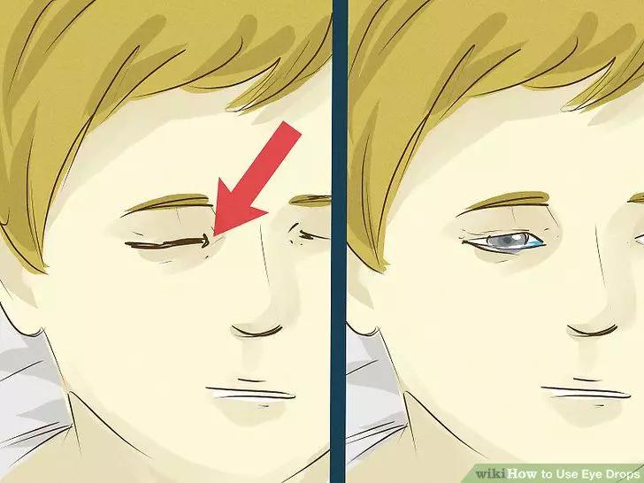 成人眼药水儿童能使用吗,儿童眼药水的正确使用方法