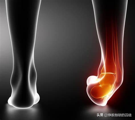 打球崴脚48小时后还要冷敷吗,打球崴脚冰敷后第二天更肿了