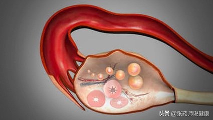 骨盆腔充血现象无法消退,骨盆发炎叫什么