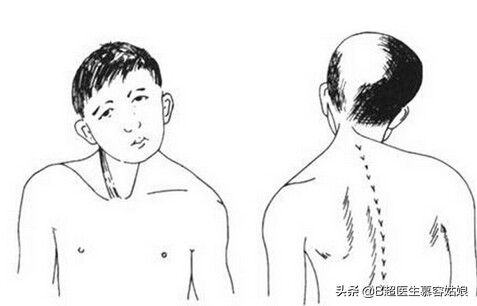 宝宝老是歪头后仰头,宝宝歪脖歪头怎么办