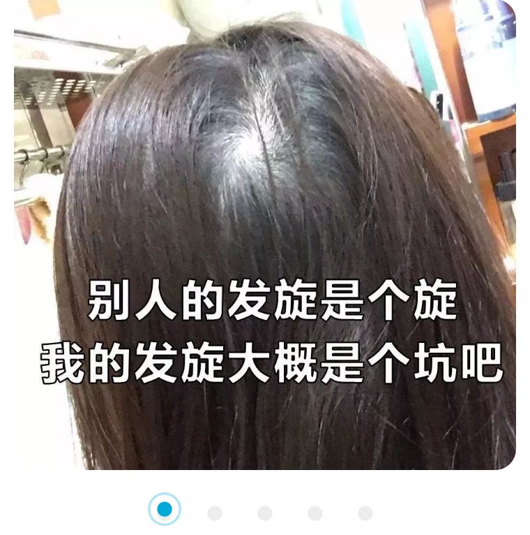 女人秃了一块怎么办,女性其实比男性秃
