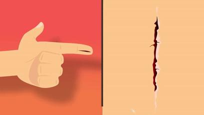 不小心被纸划伤手指怎么办,手指被纸划伤寓意