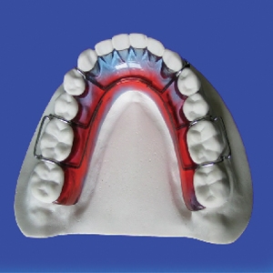 牙齿矫正结束戴保持器怎么佩戴,四十岁做牙齿矫正终身佩戴保持器