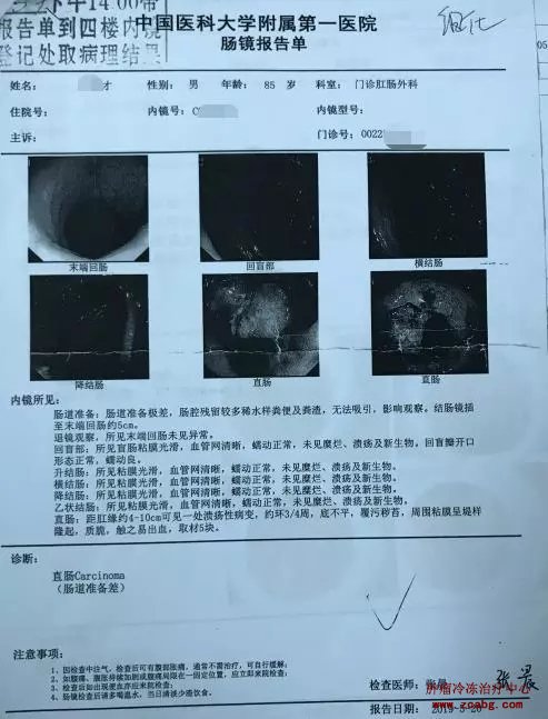 对于低位直肠癌患者，除了改道、放疗、化疗还有其他办法吗