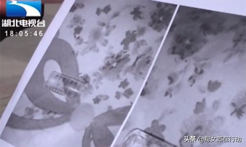 孕妇宫缩打保胎针没有效果怎么办,孕妇打了保胎针一直痛怎么办