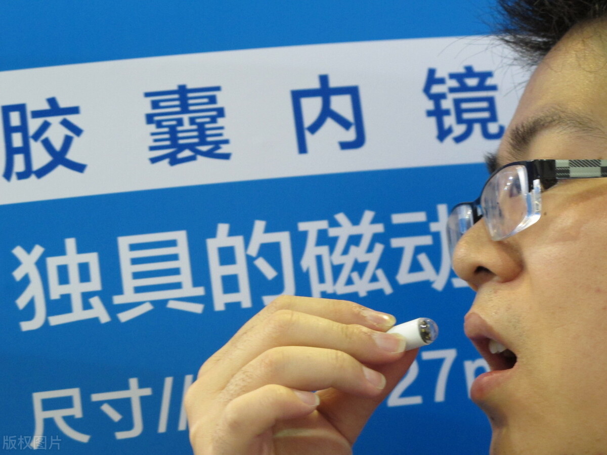 无痛胃镜和胶囊胃镜哪个比较好,胃镜检查是无痛胃镜还是普通的好