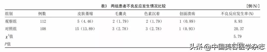 注射曲安奈德治瘢痕疙瘩,结节性痒疹曲安奈德皮下注射