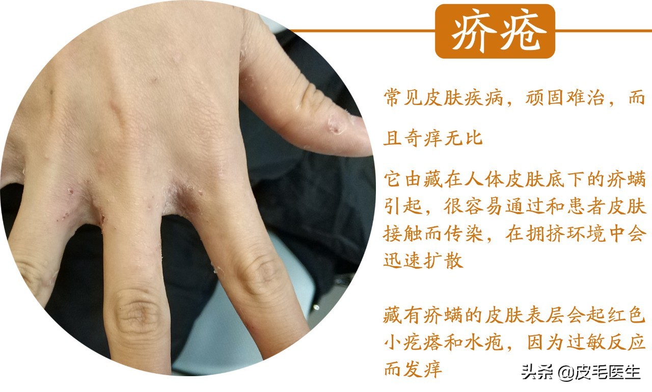 猫狗之间互相传染的病,猫狗耳螨互相传染怎么根治