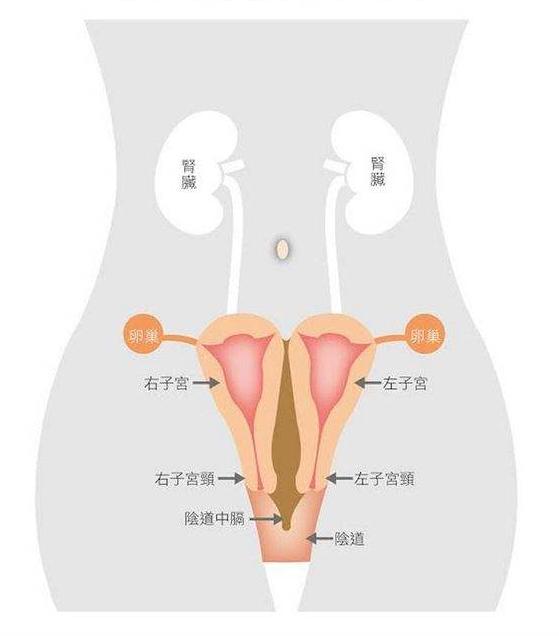 子宫腺肌症合并子宫憩室怎么办,子宫腺肌症腹腔镜子宫全切手术