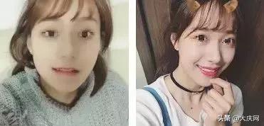 花了18000的牙齿矫正划不划算,牙齿矫正8000重庆