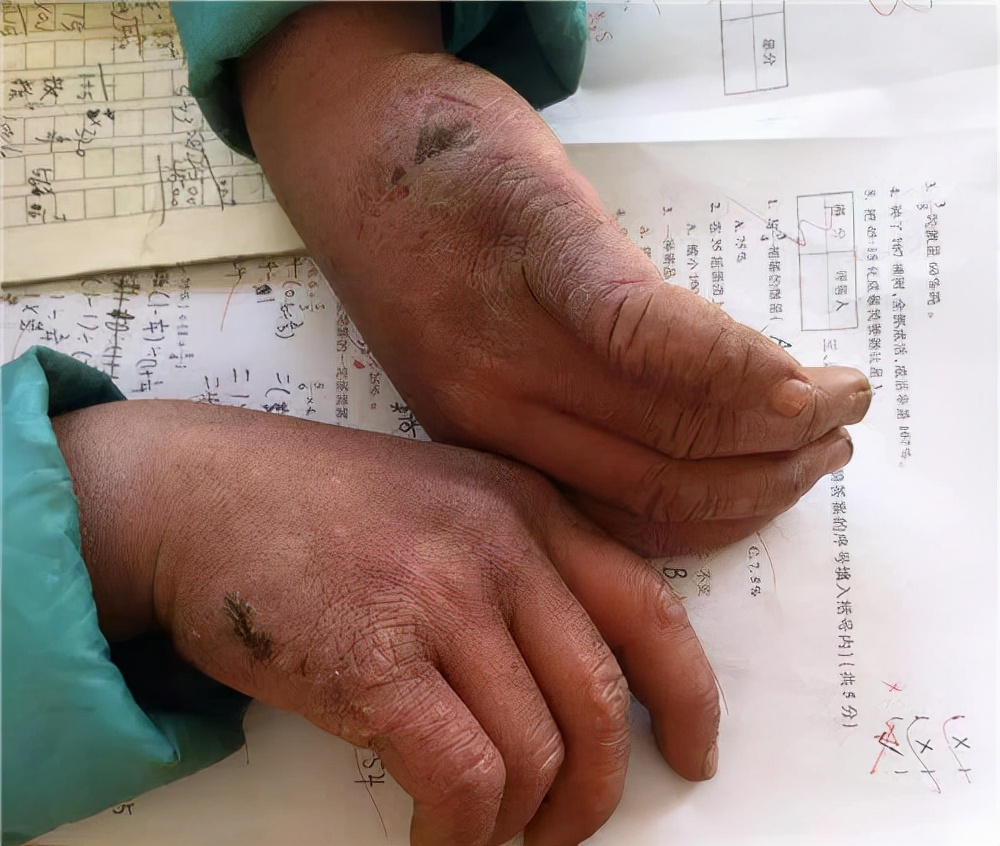 冰花男孩王福满,当年冰花男孩近况