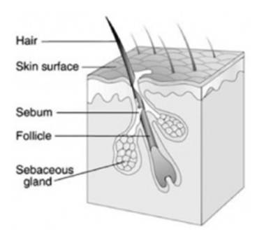 中国人为什么开始长痘痘了?