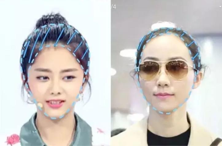 脸大怎么办自救方法,颅顶低的女生拯救办法