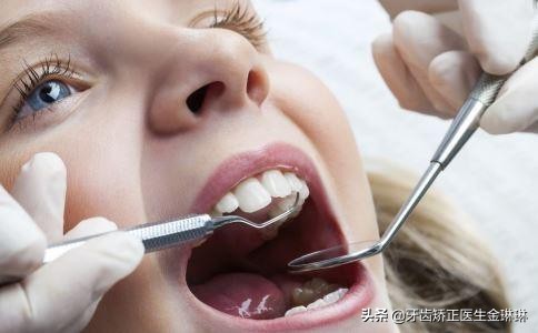 牙齿更替动态图,牙齿好看与不好看的对比