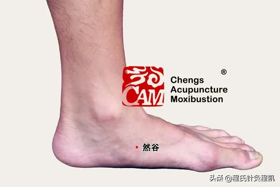 程凯针灸治疗糖尿病,程凯养生说糖尿病前期应注意什么