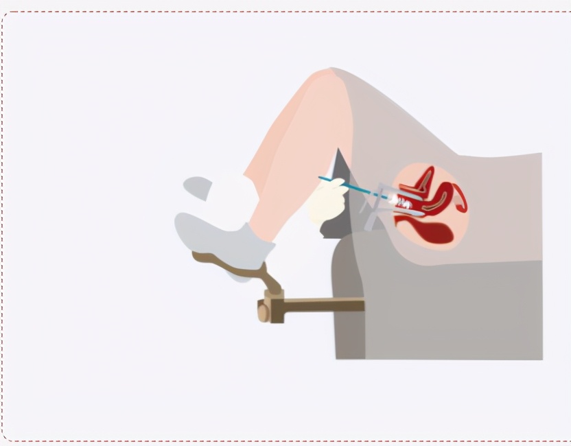 肺癌胃癌哪种治愈率大一些,早期胃癌和肺癌一起能治吗