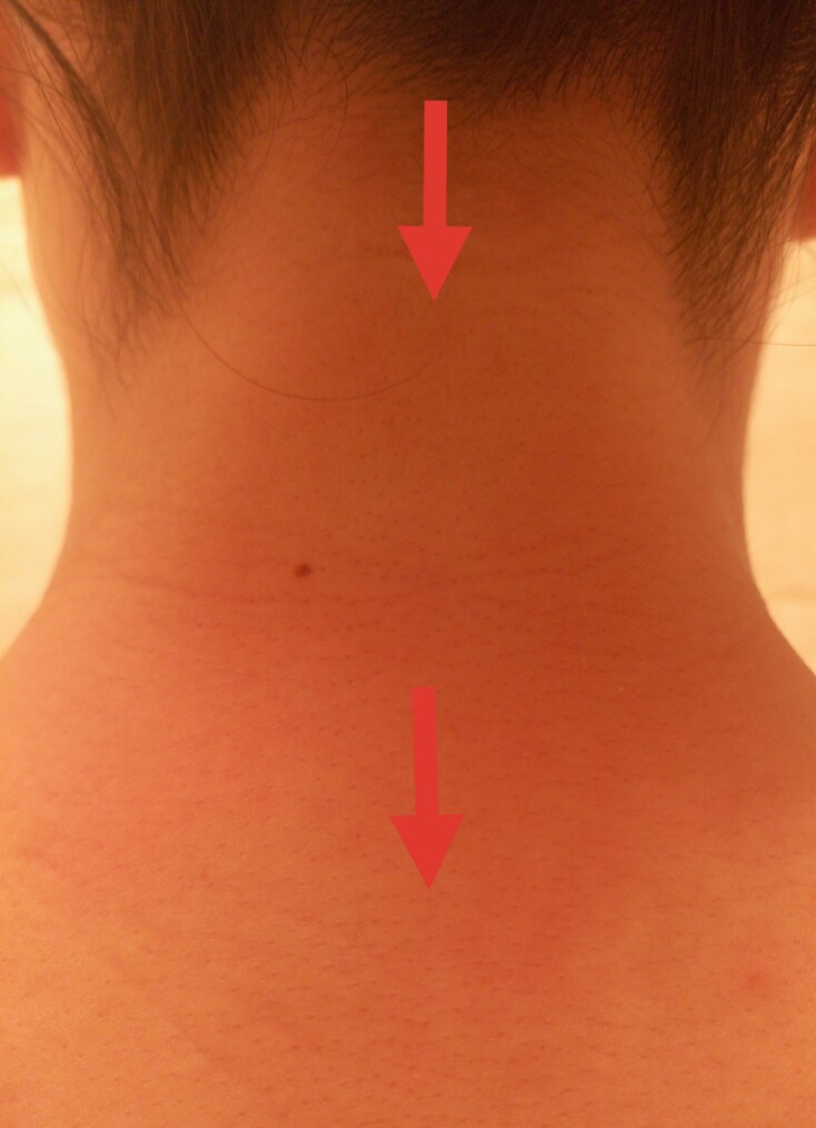 宝宝扁桃体肿大不愿意喝奶,宝宝扁桃体一直发炎不好怎么回事