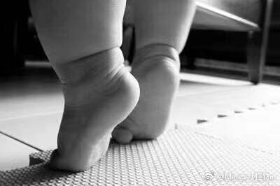 7岁小孩走路踮脚怎么纠正,一岁半宝宝踮脚走路是什么原因