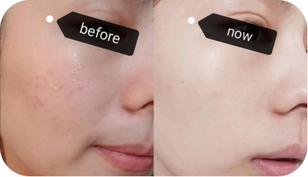 皮肤科医生的护肤真相,皮肤科医生教你怎么洗脸