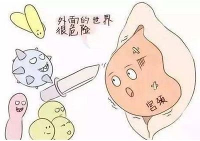 宫颈炎如果严重了是什么症状,宫颈炎多半是因为什么造成的