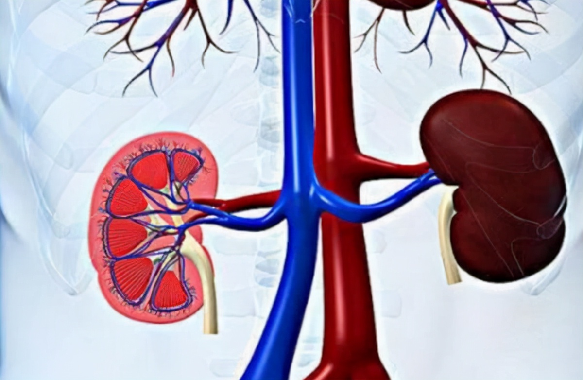 男性多囊肾怎么治疗比较好呢,70岁老人多囊肾怎么治疗