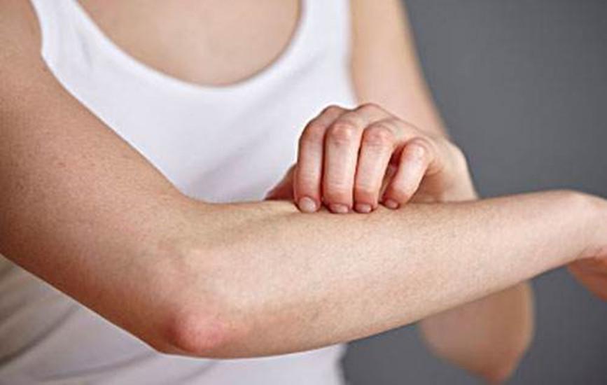 皮肤瘙痒大家有什么好的偏方吗,皮肤瘙痒别不当回事