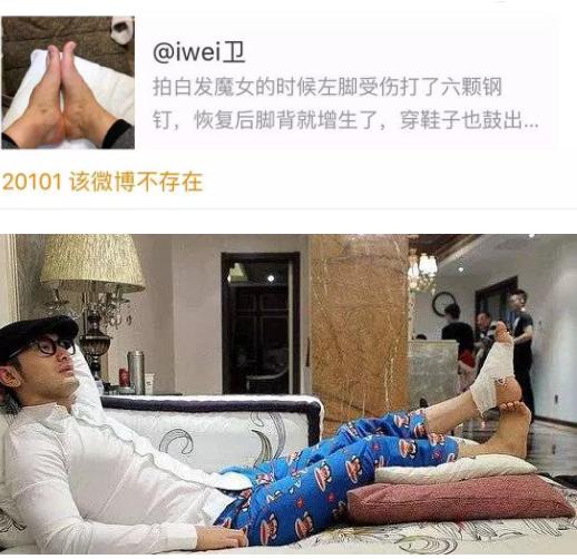 黄晓明穿增高鞋视频,黄晓明内增高现场