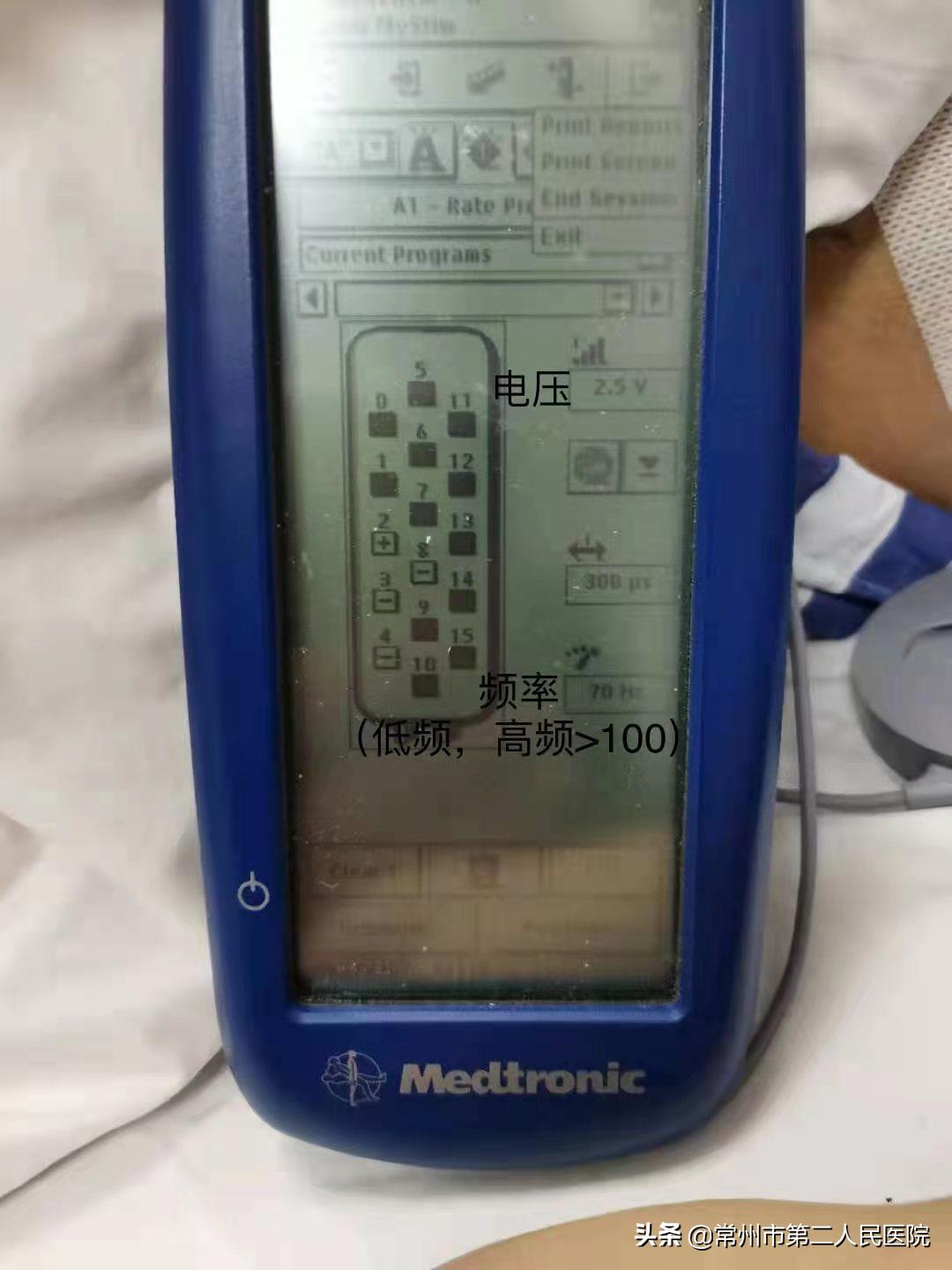 常州市二院疼痛科,常州二院疼痛科