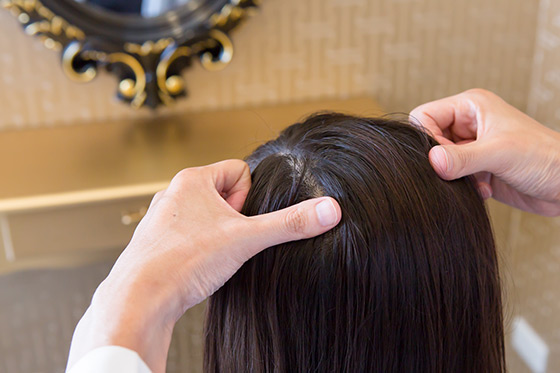 生小孩后头发掉得厉害是什么原因,头发掉光了长起来又掉是什么原因