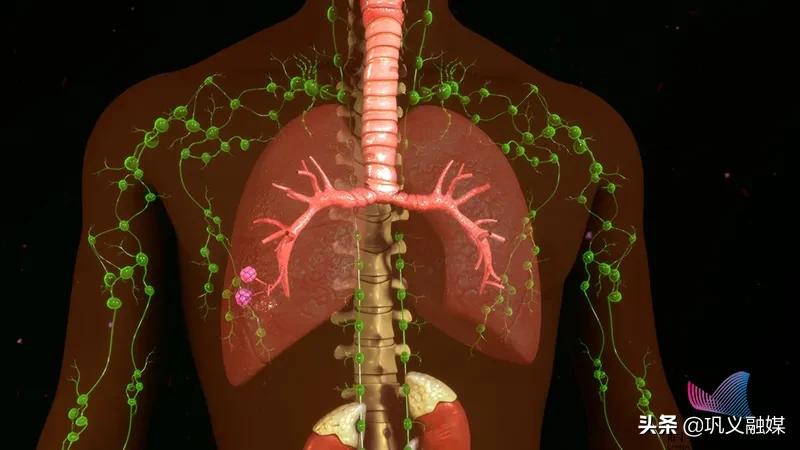 小孩淋巴瘤颈部淋巴结肿大图片,男孩淋巴结肿大1年是淋巴瘤吗
