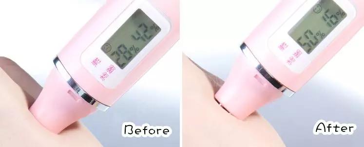 别再用针挑！用米澳拉，脂肪粒自己“掉”下来，效果胜过医美激光