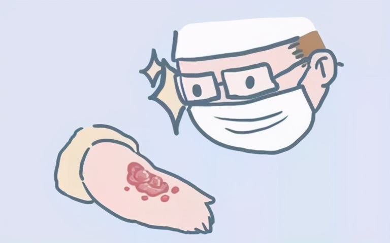 疤痕体质增生疼痛难忍,疤痕疙瘩疼痛痒痒用什么药物